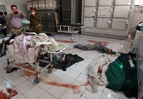 بالفيديو.. شاهد الانتحاري الاعرج منفذ التفجير الدموي في صنعاء صورة رقم 2