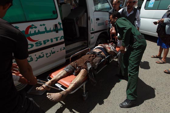 بالفيديو.. شاهد الانتحاري الاعرج منفذ التفجير الدموي في صنعاء صورة رقم 5