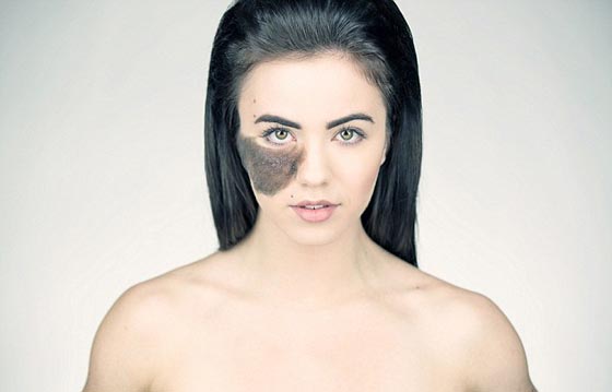 لهذا السبب تحولت عاهة راقصة استعراضية الى مصدر فخر واعتزاز.. صورة رقم 2 لهذا السبب تحولت عاهة راقصة استعراضية الى مصدر فخر واعتزاز.. صورة رقم 2