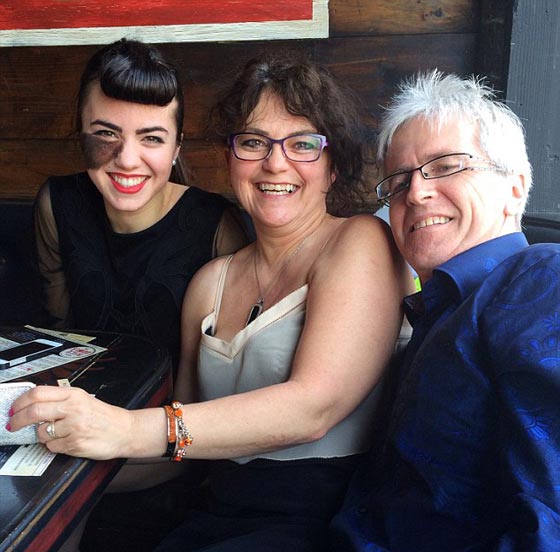 لهذا السبب تحولت عاهة راقصة استعراضية الى مصدر فخر واعتزاز.. صورة رقم 4 لهذا السبب تحولت عاهة راقصة استعراضية الى مصدر فخر واعتزاز.. صورة رقم 4