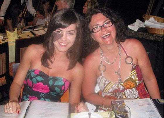 لهذا السبب تحولت عاهة راقصة استعراضية الى مصدر فخر واعتزاز.. صورة رقم 8 لهذا السبب تحولت عاهة راقصة استعراضية الى مصدر فخر واعتزاز.. صورة رقم 8