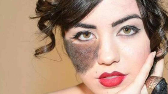 لهذا السبب تحولت عاهة راقصة استعراضية الى مصدر فخر واعتزاز.. صورة رقم 3 لهذا السبب تحولت عاهة راقصة استعراضية الى مصدر فخر واعتزاز.. صورة رقم 3