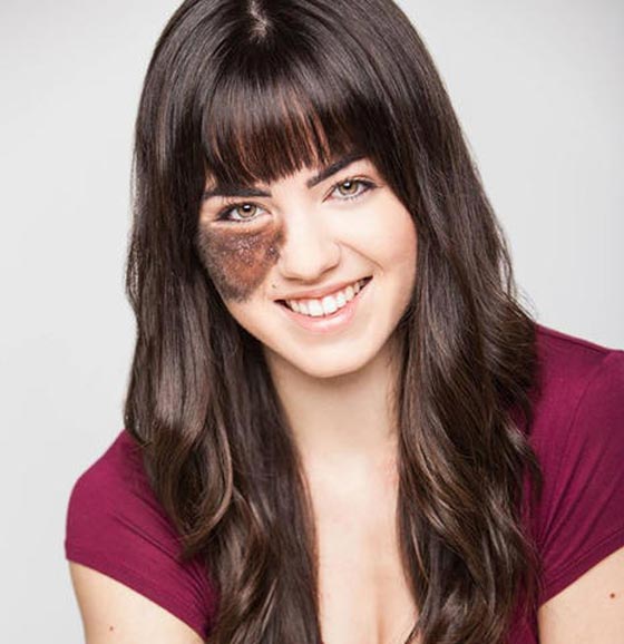 لهذا السبب تحولت عاهة راقصة استعراضية الى مصدر فخر واعتزاز.. صورة رقم 12 لهذا السبب تحولت عاهة راقصة استعراضية الى مصدر فخر واعتزاز.. صورة رقم 12