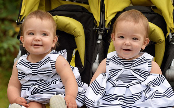 توأم ملتصق تتشابهان في كل شيء رغم فصلهما عند الولادة صورة رقم 3 توأم ملتصق تتشابهان في كل شيء رغم فصلهما عند الولادة صورة رقم 3