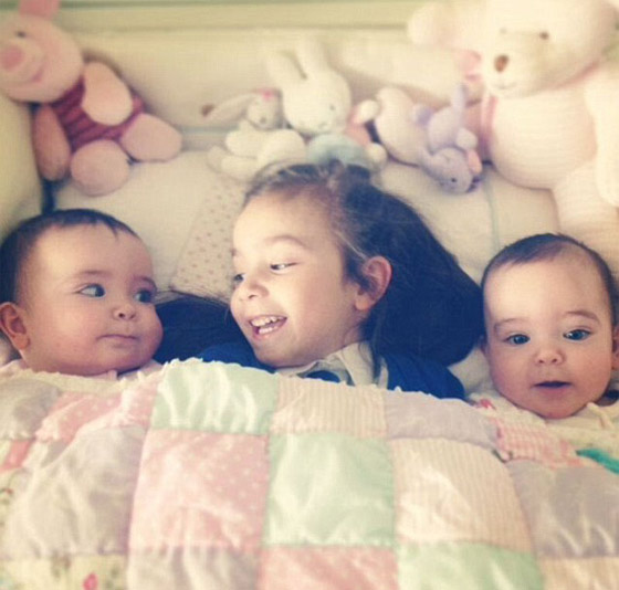 توأم ملتصق تتشابهان في كل شيء رغم فصلهما عند الولادة صورة رقم 4 توأم ملتصق تتشابهان في كل شيء رغم فصلهما عند الولادة صورة رقم 4