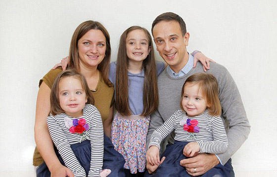 توأم ملتصق تتشابهان في كل شيء رغم فصلهما عند الولادة صورة رقم 5 توأم ملتصق تتشابهان في كل شيء رغم فصلهما عند الولادة صورة رقم 5