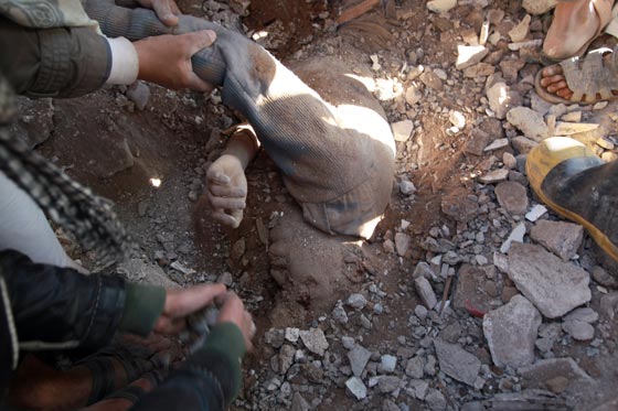 اليوم الثاني لعاصفة الحزم.. انفجارات تهز صنعاء ومعارك في عدن صورة رقم 7 اليوم الثاني لعاصفة الحزم.. انفجارات تهز صنعاء ومعارك في عدن صورة رقم 7