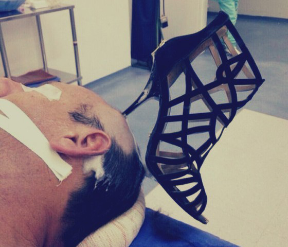 بالصورة.. سعودية تغرس كعب حذائها برأس زوجها بعد خلاف بينهما صورة رقم 1