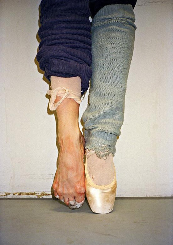 صور راقصات الباليه يفقدن غشاء البكارة بسبب التمرينات وأحذية الباليرينا تشوه أقدامهن صورة رقم 5 صور راقصات الباليه يفقدن غشاء البكارة بسبب التمرينات وأحذية الباليرينا تشوه أقدامهن صورة رقم 5