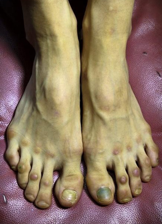 صور راقصات الباليه يفقدن غشاء البكارة بسبب التمرينات وأحذية الباليرينا تشوه أقدامهن صورة رقم 2 صور راقصات الباليه يفقدن غشاء البكارة بسبب التمرينات وأحذية الباليرينا تشوه أقدامهن صورة رقم 2