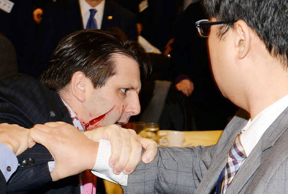 سيئولي يهاجم السفير الامريكي في بلاده بآلة حادة صورة رقم 1