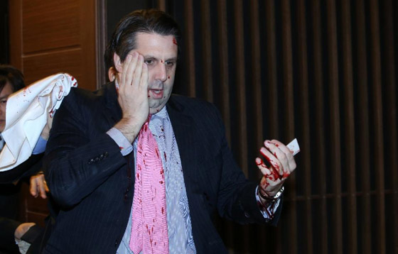 سيئولي يهاجم السفير الامريكي في بلاده بآلة حادة صورة رقم 2