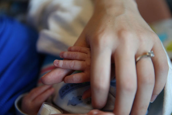 بالصور..طفل بدون انف يحل ضيفا مكرما على عالمنا ويستوطن ربوعه صورة رقم 6