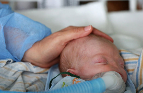 بالصور..طفل بدون انف يحل ضيفا مكرما على عالمنا ويستوطن ربوعه صورة رقم 8