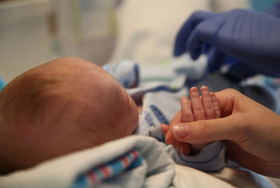 بالصور..طفل بدون انف يحل ضيفا مكرما على عالمنا ويستوطن ربوعه صورة رقم 12