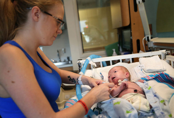 بالصور..طفل بدون انف يحل ضيفا مكرما على عالمنا ويستوطن ربوعه صورة رقم 14