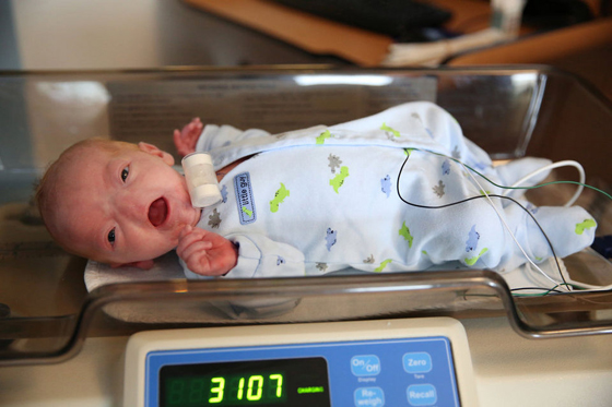 بالصور..طفل بدون انف يحل ضيفا مكرما على عالمنا ويستوطن ربوعه صورة رقم 25