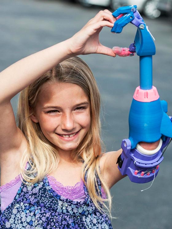 تعويض طفلة امريكية بيد مطبوعة بدلا من يدها المقطوعة صورة رقم 5