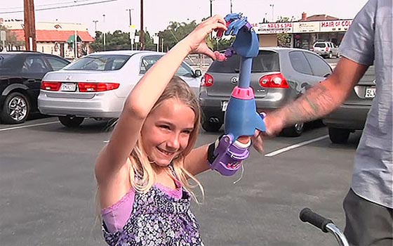 تعويض طفلة امريكية بيد مطبوعة بدلا من يدها المقطوعة صورة رقم 3