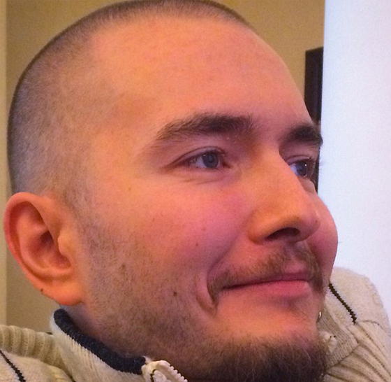  روسي مريض  يسلم رأسه لجرّاح ايطالي ليقطعه ويزرعه بجسم آخر صورة رقم 5