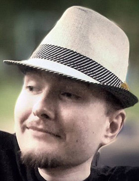  روسي مريض  يسلم رأسه لجرّاح ايطالي ليقطعه ويزرعه بجسم آخر صورة رقم 4