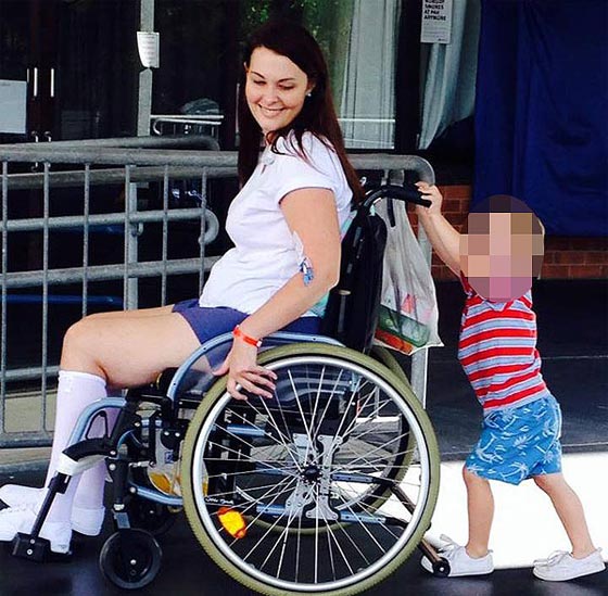 استخدمت فرشاة المكياج تعود لامرأة أخرى فأصيبت بالشلل صورة رقم 1