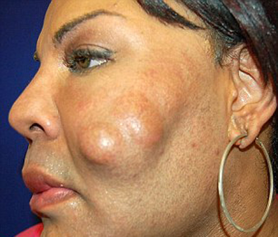 بالفيديو.. عملية التحول النوعي جعلت من الرجل امرأة مشوهة صورة رقم 3