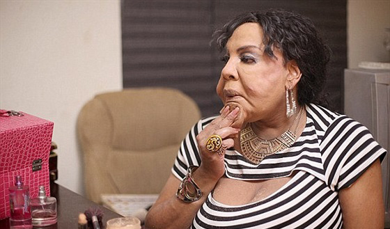 بالفيديو.. عملية التحول النوعي جعلت من الرجل امرأة مشوهة صورة رقم 5