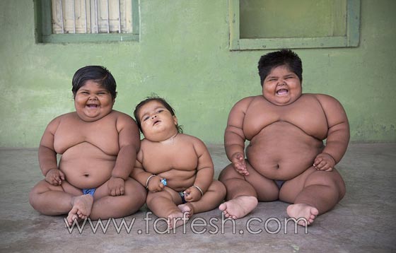 صور غريبة وفيديو.. اب يبيع كليته ليعالج أطفاله المهددين بالموت لسمنتهم المفرطة  صورة رقم 1