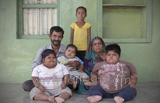 صور غريبة وفيديو.. اب يبيع كليته ليعالج أطفاله المهددين بالموت لسمنتهم المفرطة  صورة رقم 3