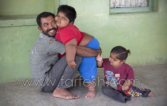 صور غريبة وفيديو.. اب يبيع كليته ليعالج أطفاله المهددين بالموت لسمنتهم المفرطة  صورة رقم 5