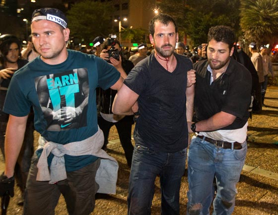 تل ابيب تشتعل وصدامات عنيفة بين الشرطة والاثيوبيين صورة رقم 4 تل ابيب تشتعل وصدامات عنيفة بين الشرطة والاثيوبيين صورة رقم 4