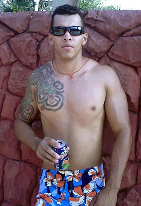 فيديو وصور برازيلي يحقن عضلاته بالزيت والكحول ويعرّض ذراعيه لخطر البتر صورة رقم 10