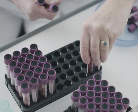 مجلة نمسوية تتضامن مع مصابي نقص المناعة بطباعتها عددا ممزوجا بدمائهم!! صورة رقم 1 مجلة نمسوية تتضامن مع مصابي نقص المناعة بطباعتها عددا ممزوجا بدمائهم!! صورة رقم 1