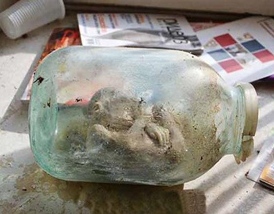 بالصور.. طالب يعثر على جثث أجنة الأطفال داخل مختبر مهجور  صورة رقم 5