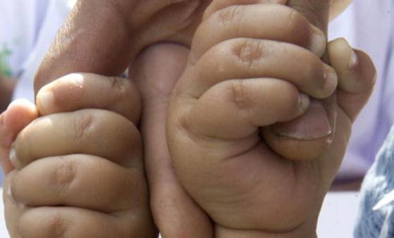 صدق او لا تصدق.. توأمان من والدين مختلفين!! صورة رقم 1