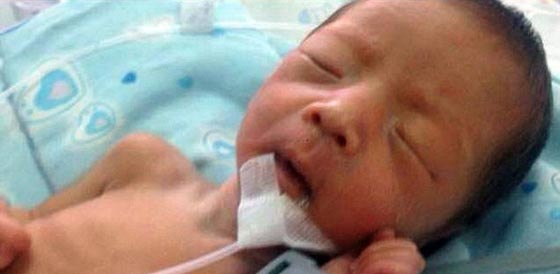 ترك 10 أيام في البرية ودفن حيا.. مولود صيني يتشبث بالحياة صورة رقم 3 ترك 10 أيام في البرية ودفن حيا.. مولود صيني يتشبث بالحياة صورة رقم 3