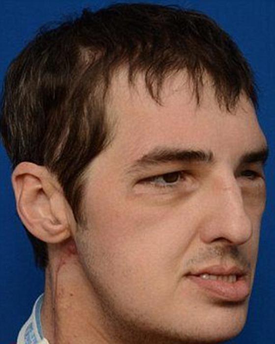 واشنطن.. امراة تتعرف على وجه اخيها المتوفى بعد زراعته لرجل اخر صورة رقم 7 واشنطن.. امراة تتعرف على وجه اخيها المتوفى بعد زراعته لرجل اخر صورة رقم 7