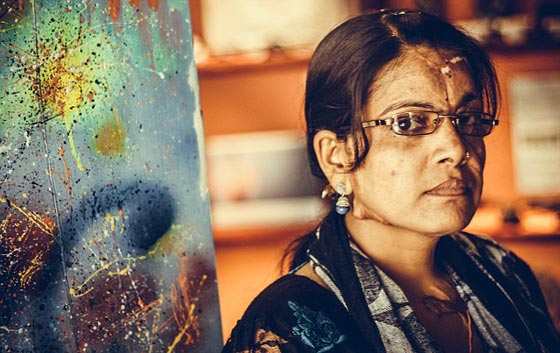 انتقاما من زوجته.. اب سكّير يرشق طفلته بمادة حارقة لتعيش مشوّهة! صورة رقم 6