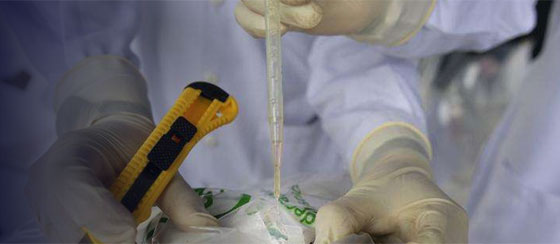 طريقة جهنمية.. تهريب الكوكايين في ثديين مزروعين لامرأة!! صورة رقم 1