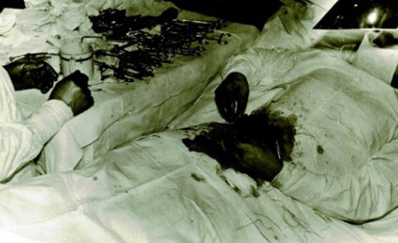 طبيب روسي أجرى عملية لنفسه مستخدمًا مرآة صورة رقم 3 طبيب روسي أجرى عملية لنفسه مستخدمًا مرآة صورة رقم 3