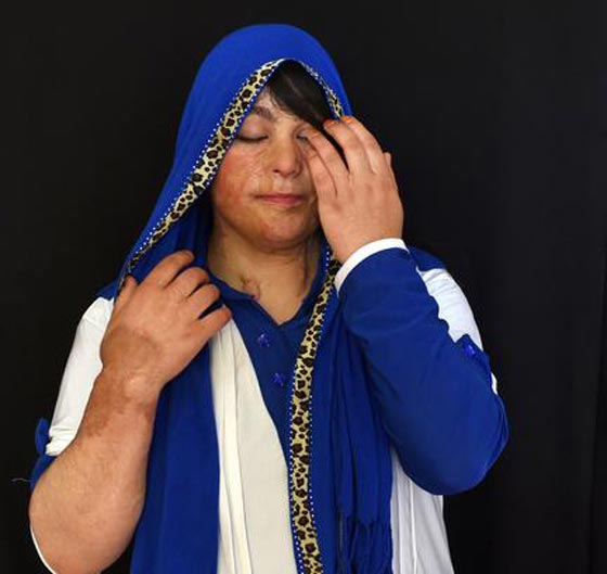 القتل او التشويه نصيب المرأة الافغانية اذا رفضت الحجاب او العريس صورة رقم 1