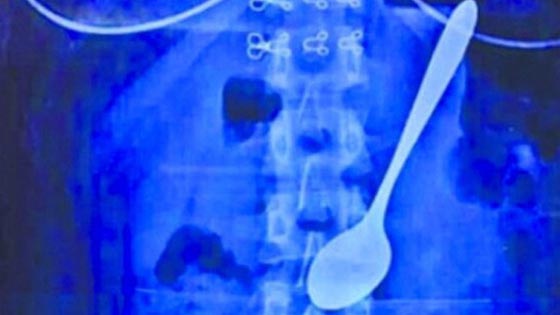 طالبة صينية تبتلع ملعقة الايس كريم بعد دفع زميل لها من الخلف صورة رقم 1