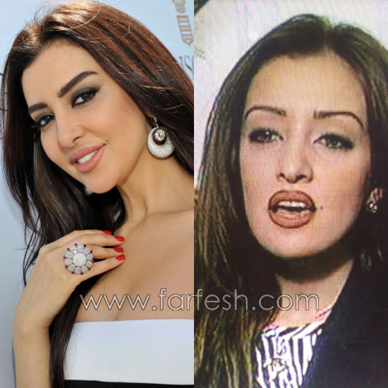 صور ميساء مغربي قبل وبعد عمليات التجميل صورة رقم 1