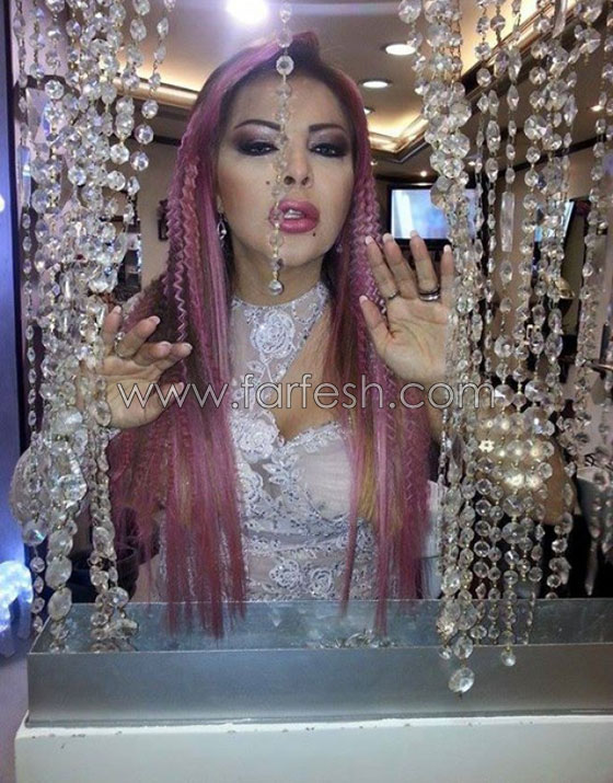 فلة الجزائرية: طبيب التجميل أكثر حناناً عليّ من أمي وأبي   صورة رقم 5