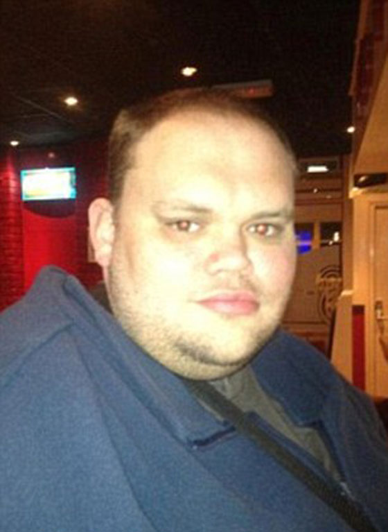 صور اسمن رجل في العالم الذي توفي بعد ان رفض التوقف عن الطعام صورة رقم 3