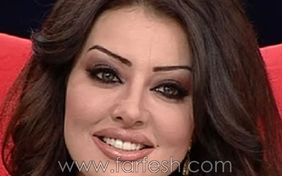 صور ميساء مغربي قبل وبعد عمليات التجميل صورة رقم 11