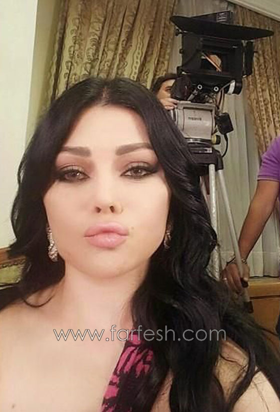 مسلسلات رمضان: صور الفنانات يتسابقن لشد الوجه، تكبير الشفاه ونفخ الوجنتين!  صورة رقم 3