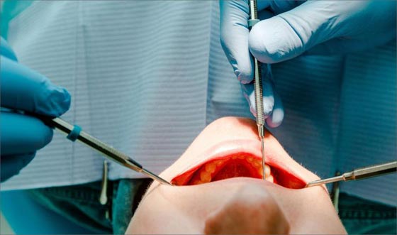  حيّر العلماء.. لماذا فقد الجندي البريطاني ذاكرته اثناء جراحة الأسنان؟ صورة رقم 4