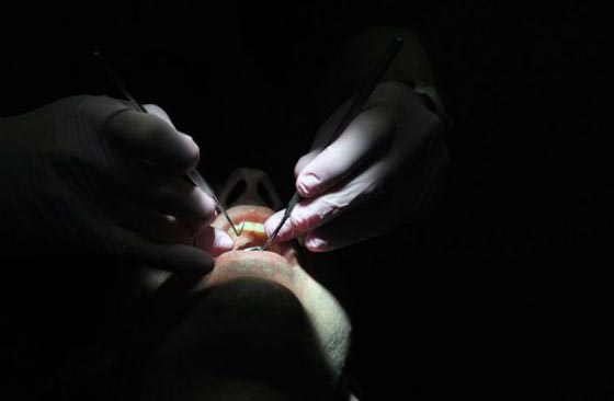  حيّر العلماء.. لماذا فقد الجندي البريطاني ذاكرته اثناء جراحة الأسنان؟ صورة رقم 1